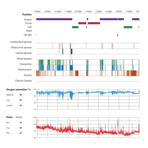 Máy đo đa ký Hô hấp ResMed Apnealink Air